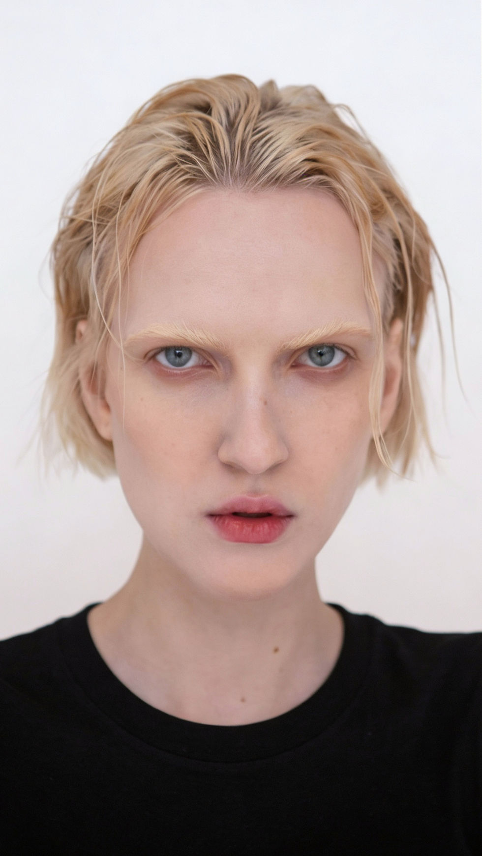 Dermal filler treatment performed by doctor-led clinic