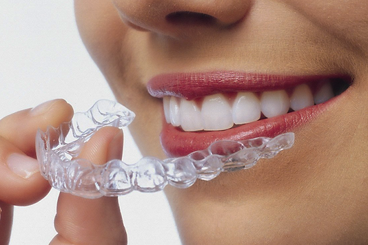 invisalign.png