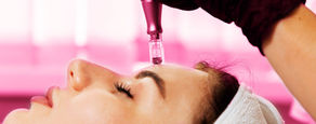 Microneedling: Little needles that do BIG things!