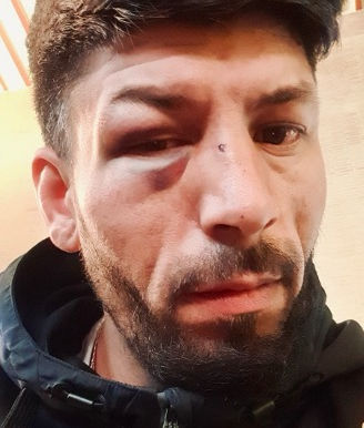 Violence and Exploitation Among Romanian Workers in the Netherlands