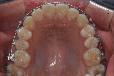 부산연산동청소년교정
