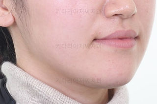 부산임플란트교정