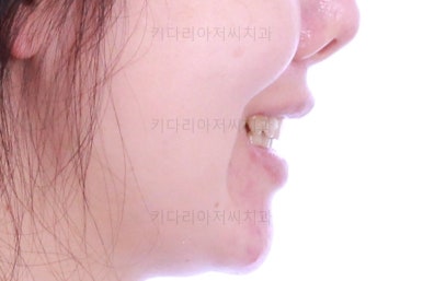 부산재교정치과