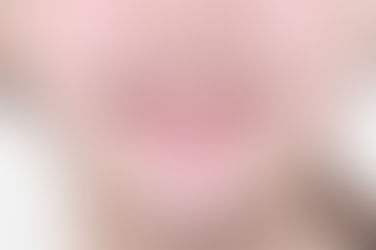 부산덧니교정