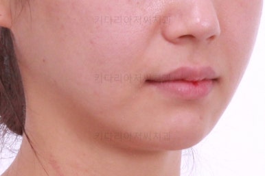 연산동교정치과