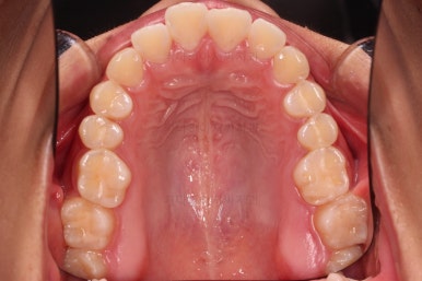 부산연산역치아교정