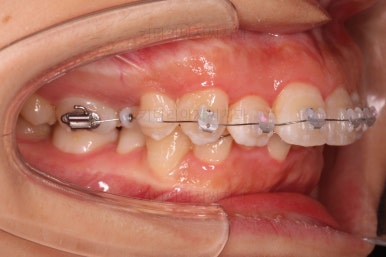 부산무턱교정치과