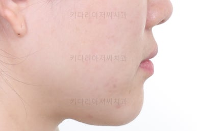 부산인비절라인