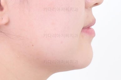 연산동교정치과