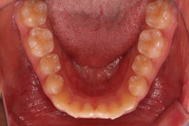 사직동교정치과