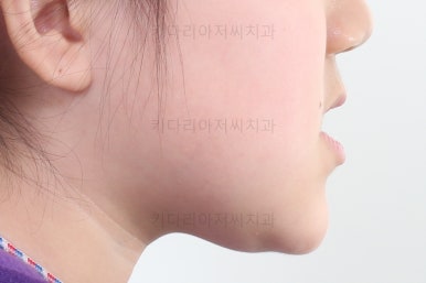 부산초등학생교정