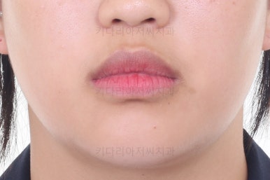 사직동교정치과