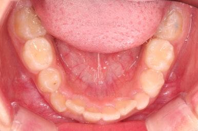 부산어린이교정