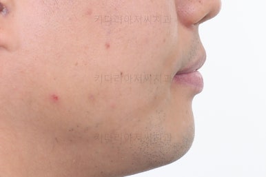 부산교정치과추천