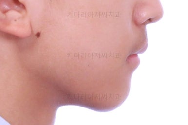 부산교정치과추천