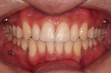 부산연제구교정