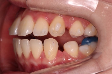 부산교정전문의