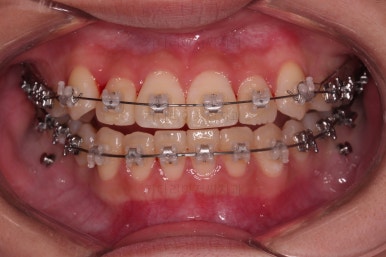 연산동교정치과