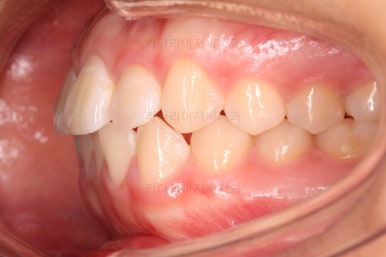 사직동교정치과