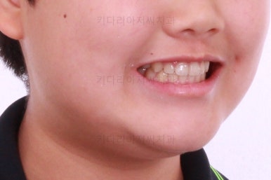 부산교정치과추천