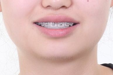 부산교정치과