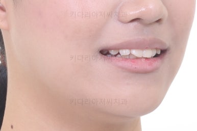 연산동치아교정치과