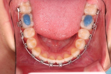 부산치아교정치과