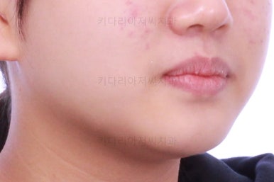 부산교정전문의