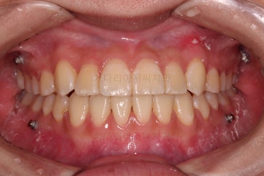 연산동교정치과