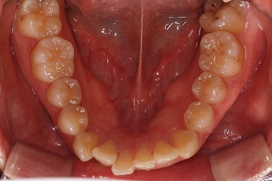 부산연산동교정치과