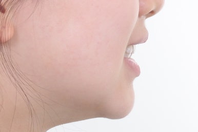 부산치아교정잘하는곳