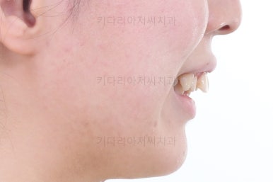 부산무턱교정치과