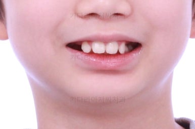 부산어린이교정