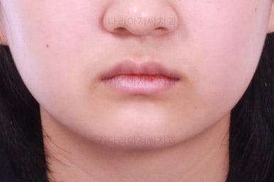 부산청소년교정치과