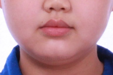 부산교정치과추천