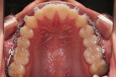 부산연제구교정