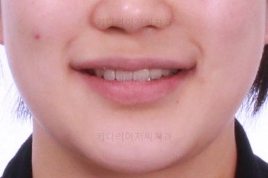 사직동교정치과