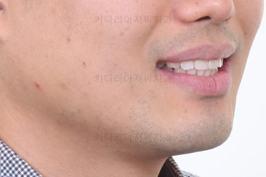 부산교정치과추천