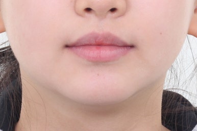 부산치아교정잘하는곳