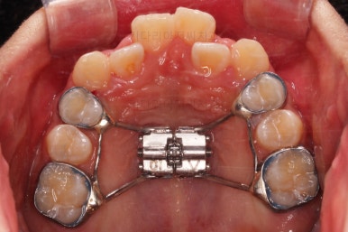 부산청소년교정