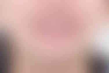 부산치아교정잘하는곳