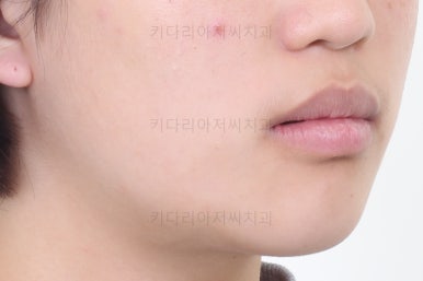 사직동교정치과