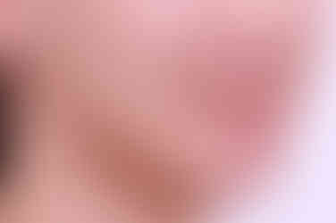 부산비대칭교정