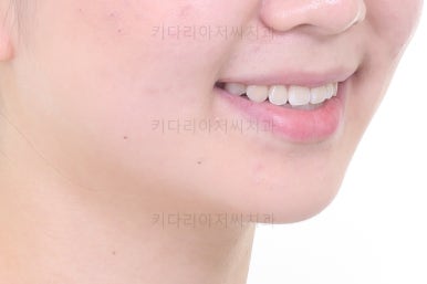 부산치아교정잘하는곳