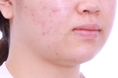 부산치아교정치과