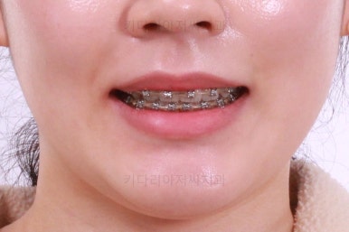 부산교정