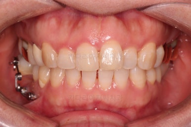 연산동부분교정