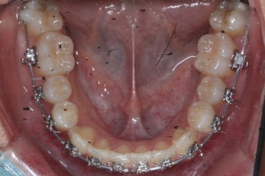 부산연산동청소년교정