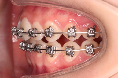 부산청소년교정치과