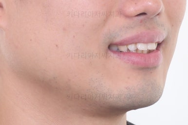 부산교정치과추천